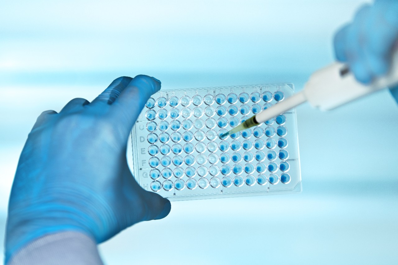 hands of scientist in the biochemical lab with pipette and multiwells plate / technician pipetting plate multiwell in the laboratory